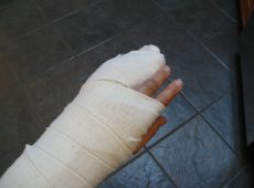 Is gardening still possible with an injured hand?