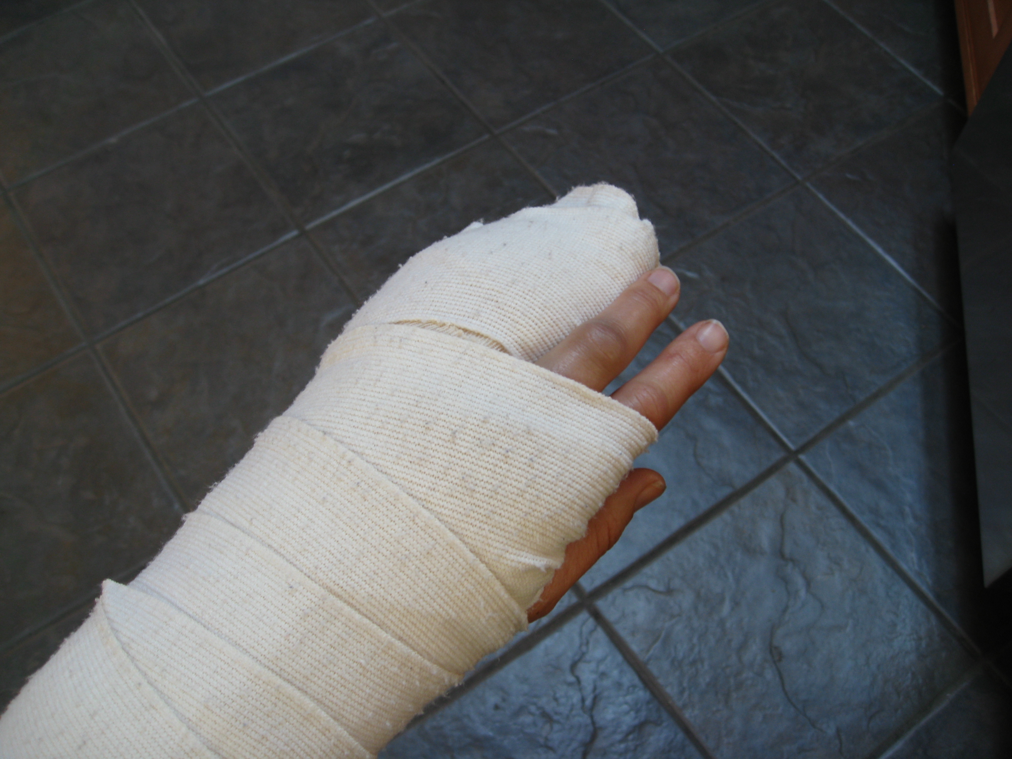 Is gardening still possible with an injured hand?